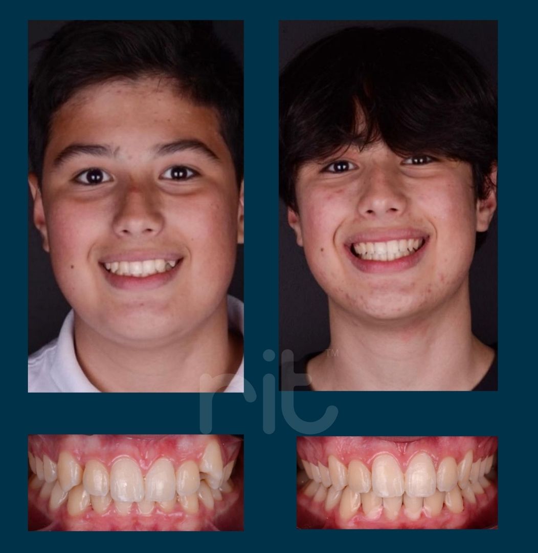 Orto 11